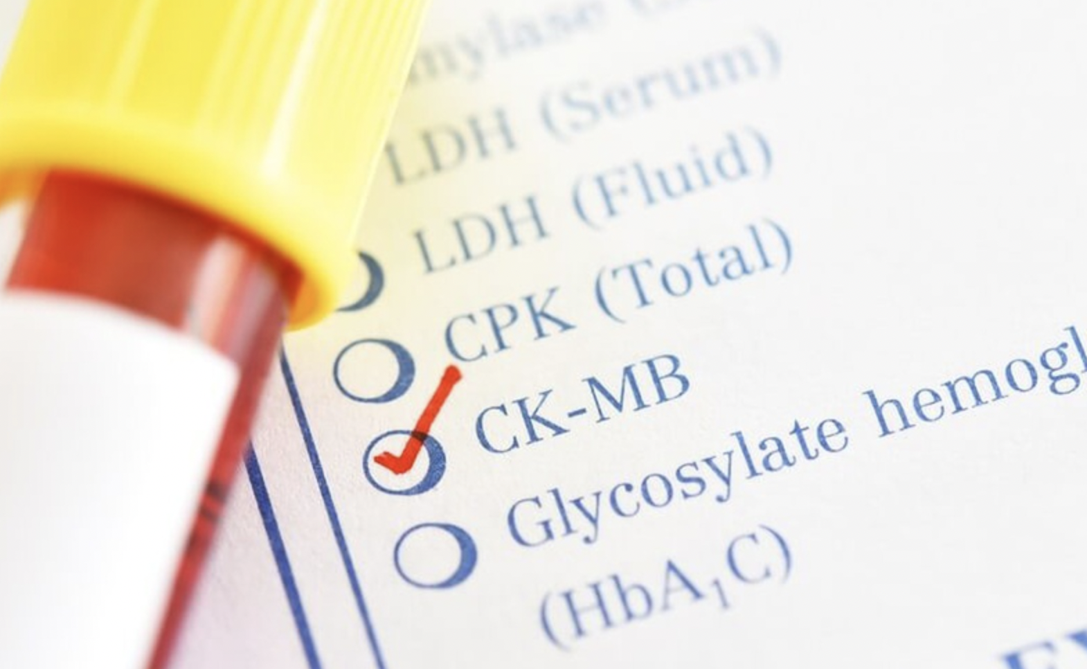Xét nghiệm CK-MB là gì?