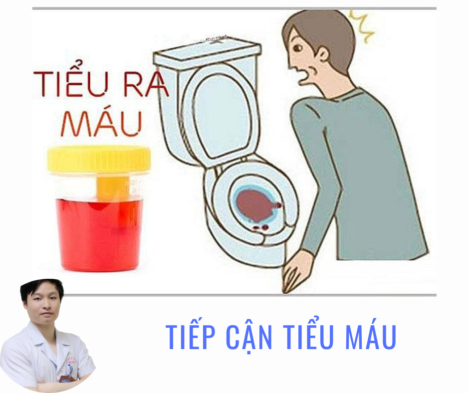 Tiếp cận tiểu máu