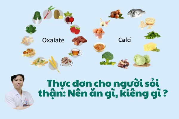 Thực đơn cho người sỏi thận: Các loại thực phẩm tốt cho người sỏi thận như cam, chanh, sữa